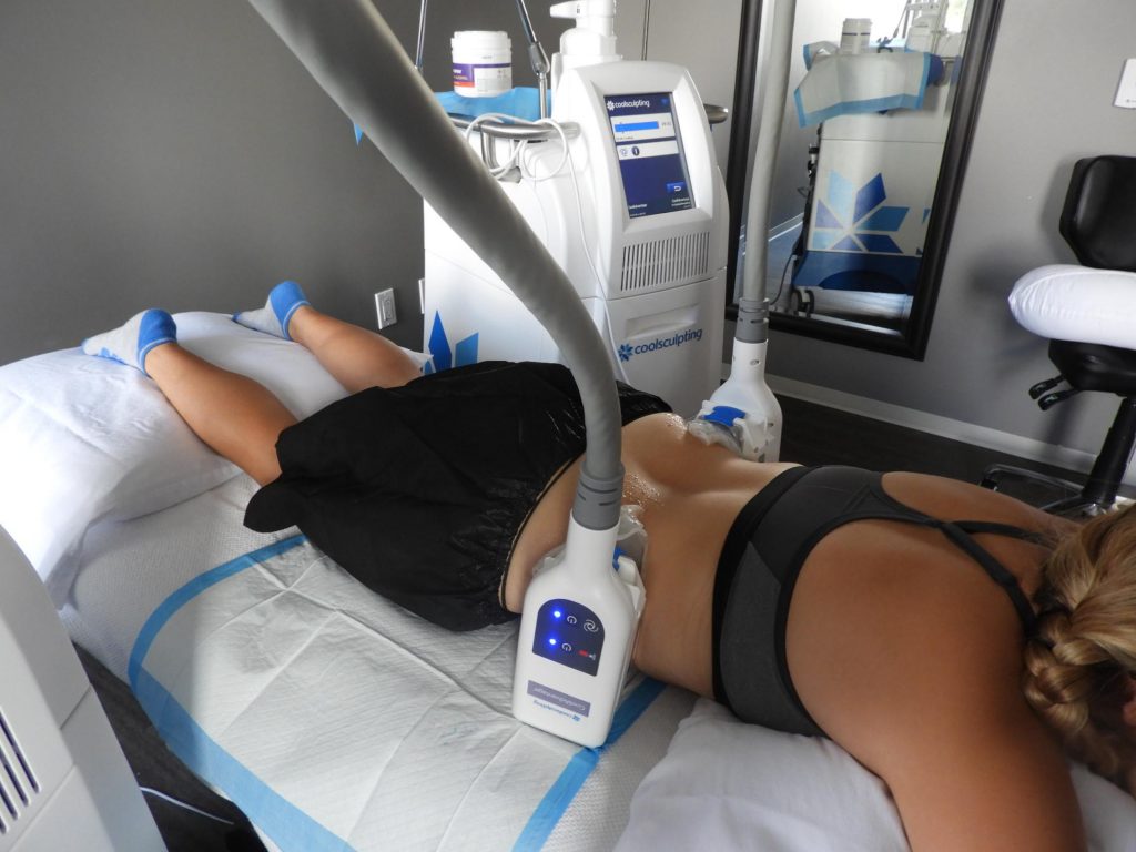 CoolSculpting Houston